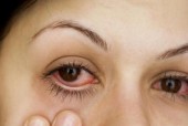 眼睛干涩最快的解决方法是什么？如何快速缓解眼部不适？