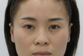 以咬肌肥大怎么办（解析以咬肌肥大的原因）