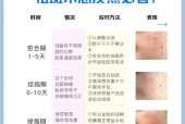 告别脸上色斑，拥有晶莹剔透肌肤（最有效的去斑方法和小贴士）