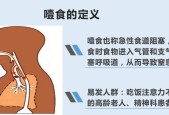 吃饭噎住怎么办？掌握正确的急救方法至关重要？