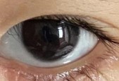 宝宝眼睫毛倒长的原因和处理方法（解读宝宝眼睫毛倒长的常见原因和正确处理方式）