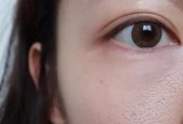 缩小毛孔粗大的有效方法（让你远离毛孔困扰的15个实用技巧）
