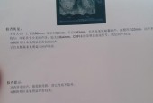怀孕初期葡萄胎有哪些症状？如何识别葡萄胎的早期迹象？