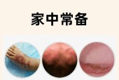 热油烫伤处理方法（急救措施及后续护理指南）