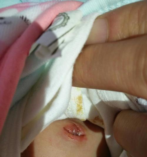 宝宝肚脐怎么清洗（宝宝肚脐清洗技巧及注意事项）  第3张