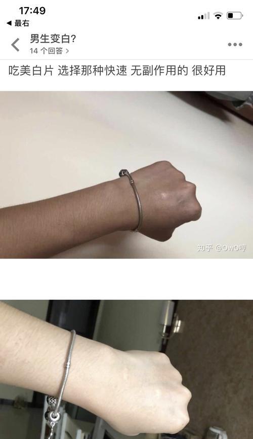 晒黑后如何快速美白（掌握关键步骤）  第3张