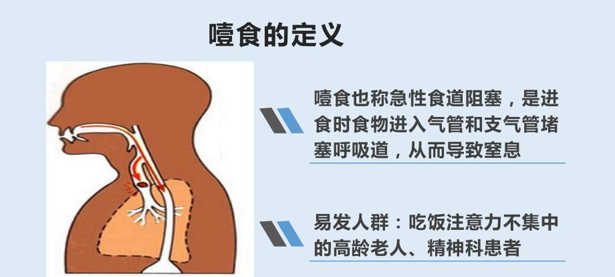 吃饭噎住怎么办？掌握正确的急救方法至关重要？  第1张