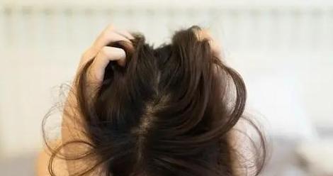 17岁头发稀疏怎么办？有效恢复方法有哪些？  第3张
