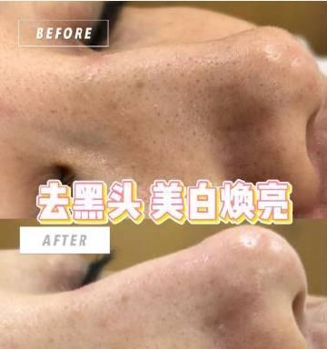 华为笔记本清洁去黑头方法？有效技巧有哪些？  第3张