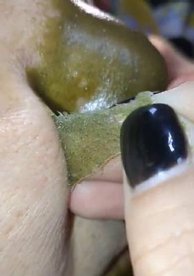 华为笔记本清洁去黑头方法？有效技巧有哪些？  第2张
