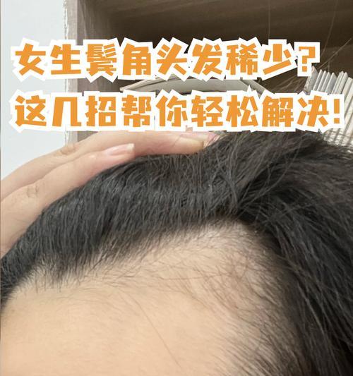 如何应对头发稀少问题（探讨头发稀少的原因）  第2张