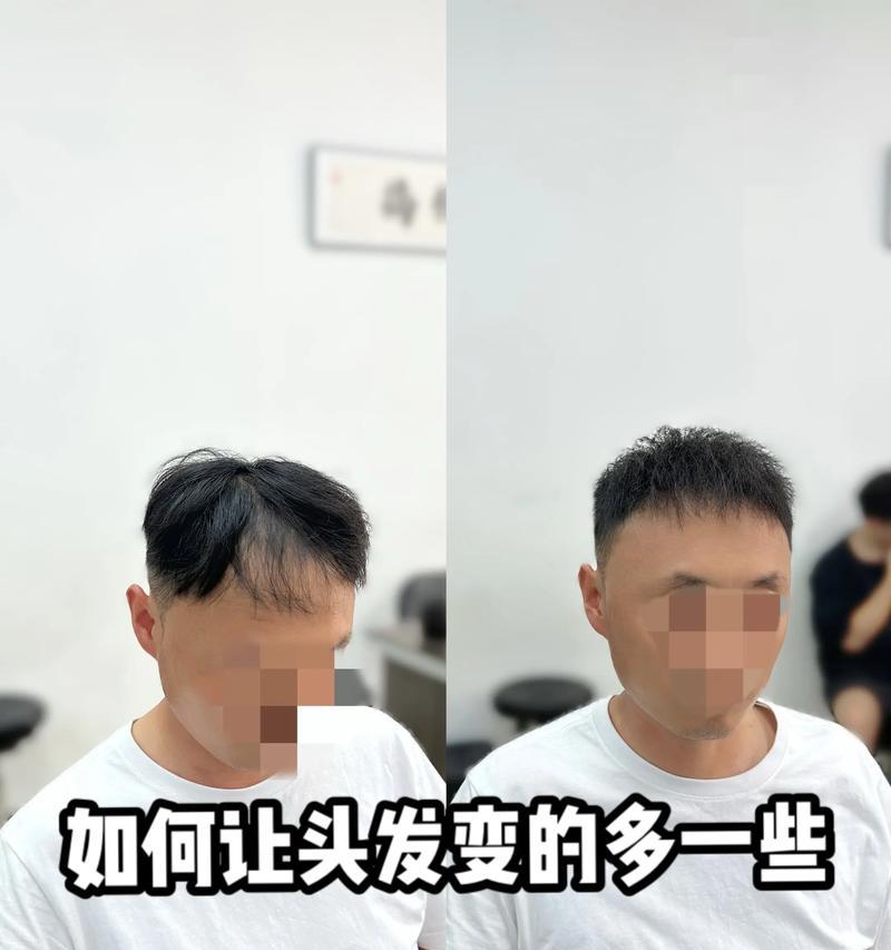 如何应对头发稀少问题（探讨头发稀少的原因）  第1张
