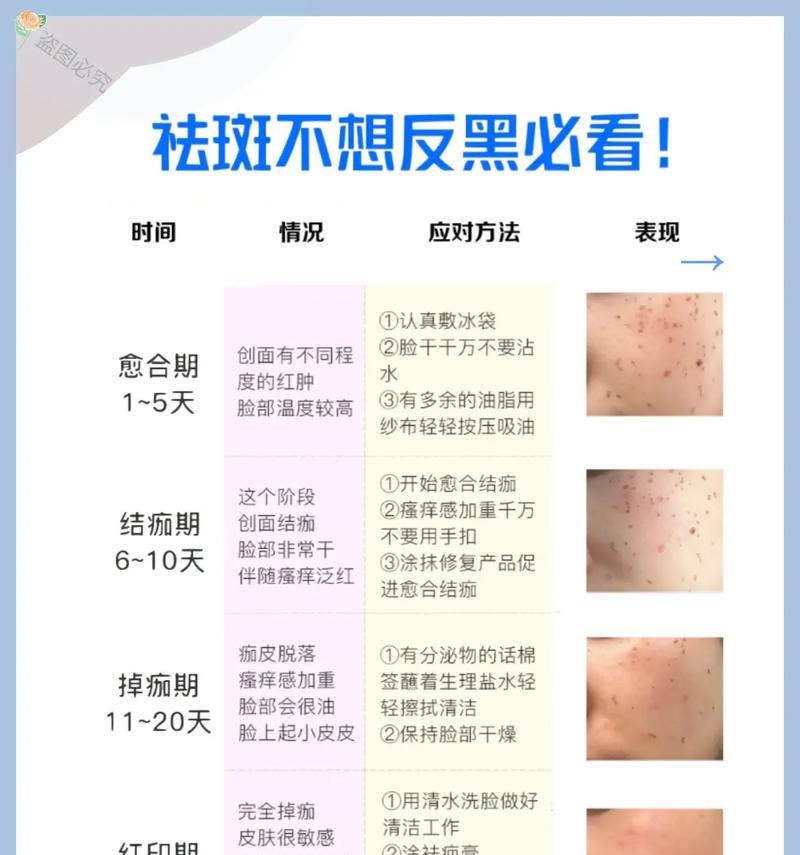 告别脸上色斑，拥有晶莹剔透肌肤（最有效的去斑方法和小贴士）  第1张