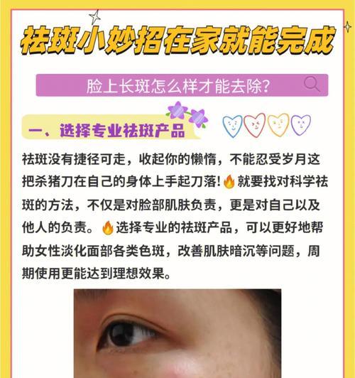告别脸上色斑，拥有晶莹剔透肌肤（最有效的去斑方法和小贴士）  第2张