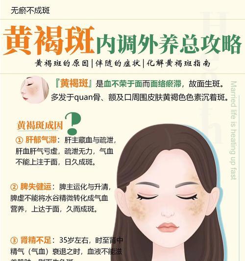 告别脸上色斑，拥有晶莹剔透肌肤（最有效的去斑方法和小贴士）  第3张